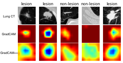 CAM visualization example