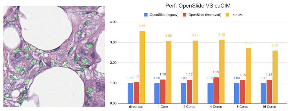 digital pathology