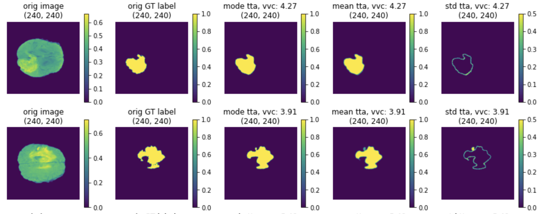test time augmentation